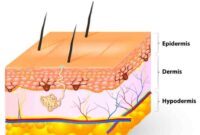 Skin Health: Prevention and Treatment of Skin Breakdown