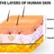 Skin Health: Prevention and Treatment of Skin Breakdown